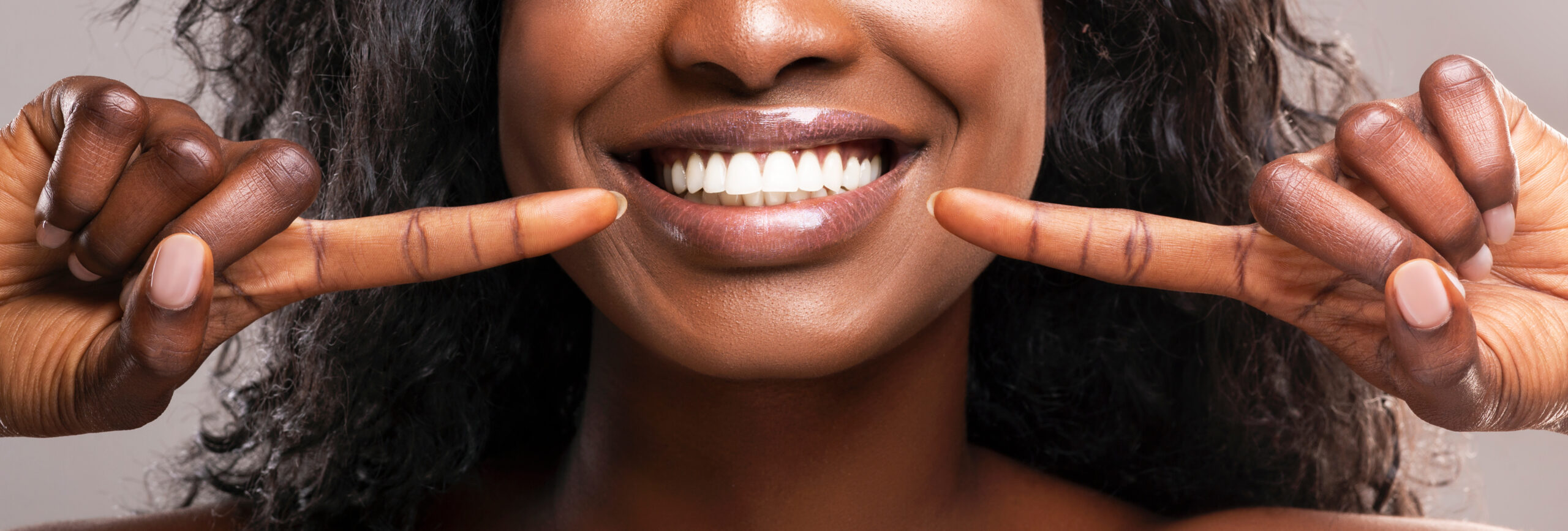 Close-up of a smiling black woman pointing to her bright, white teeth with both index fingers, advertising teeth whitening or cosmetic dentistry.